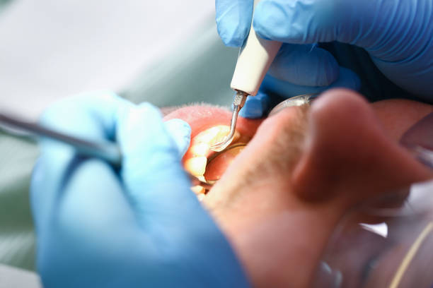 Best Emergency Gum Treatment in Flushing, MI