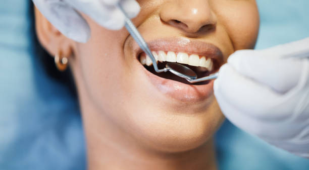 Best Emergency Wisdom Teeth Removal in Flushing, MI